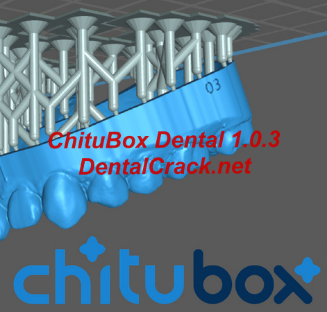 ChituBox Dental 1.0.3 crack FULL